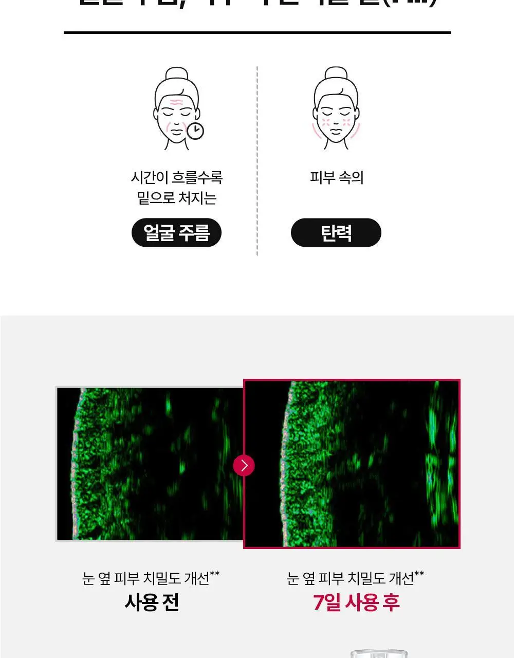[윤곽앰플] 메디톡스 뉴라덤 코어타임 앰플 15ml [기획(+7ml)/단품] 상세페이지 30
